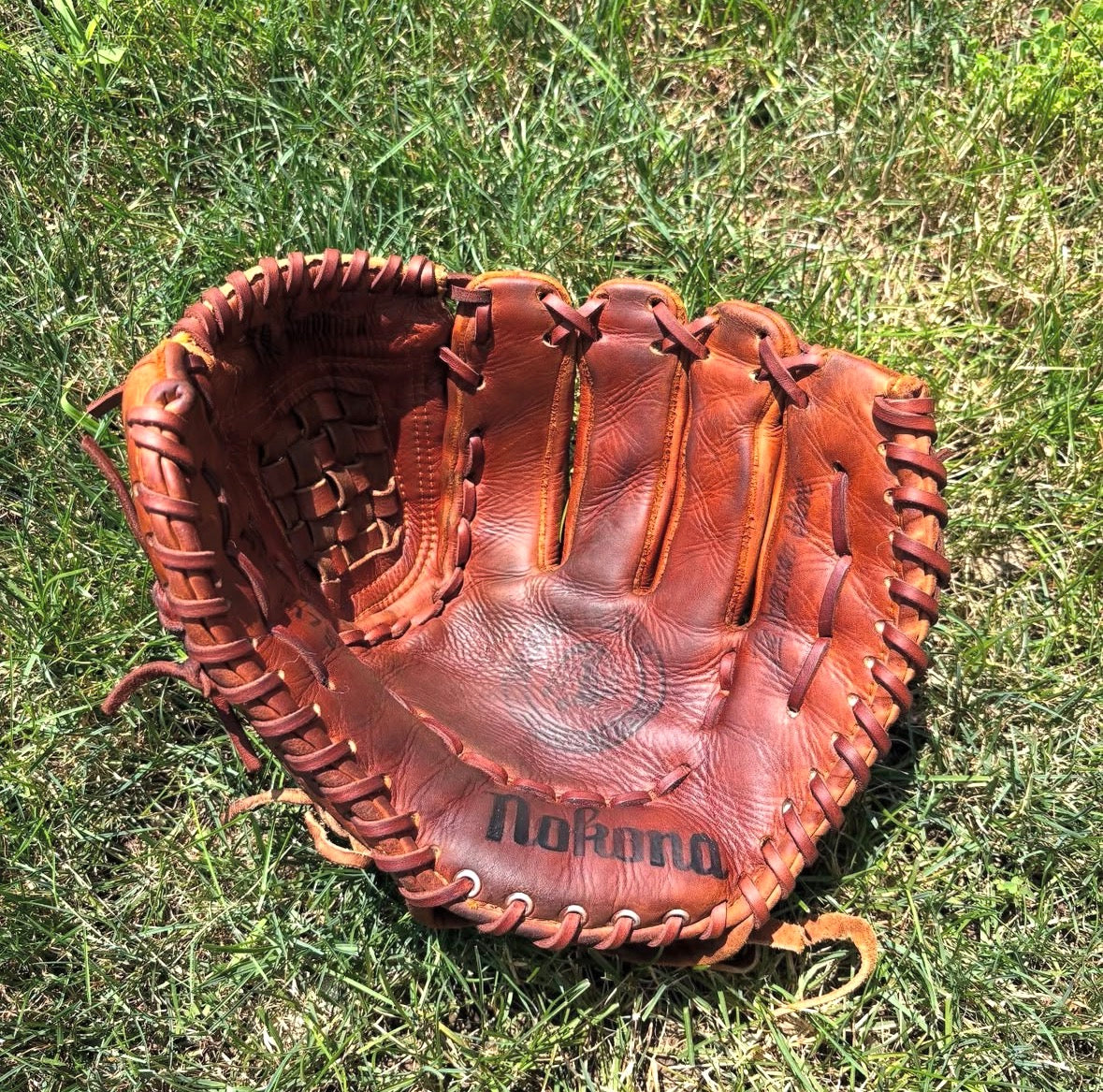 After glove restoration